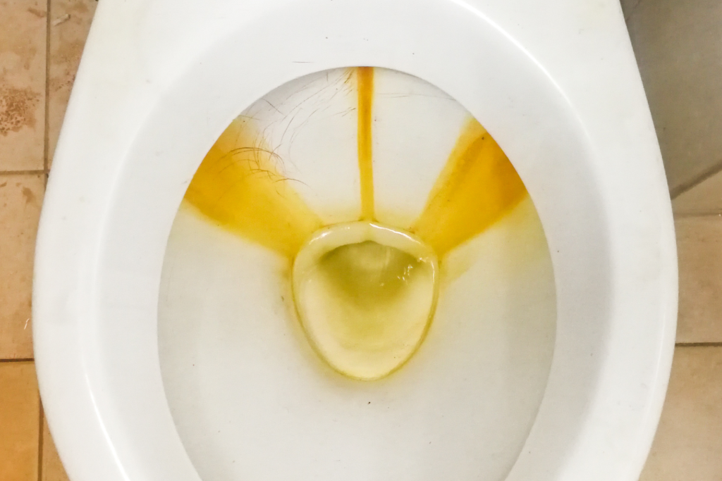 Yellow Stain Around Toilet Base